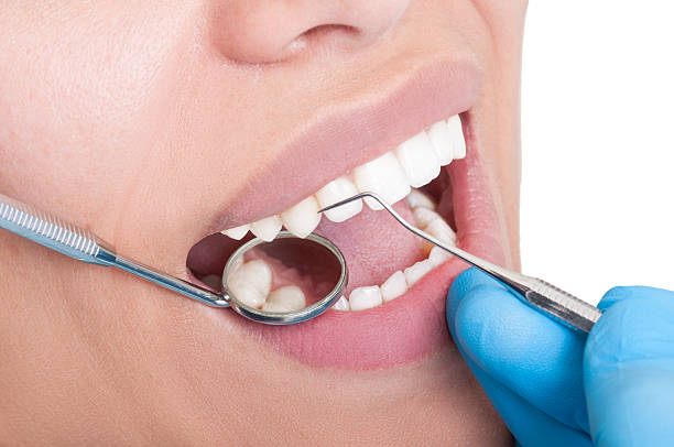 istock Oral hygienist at work 533666931