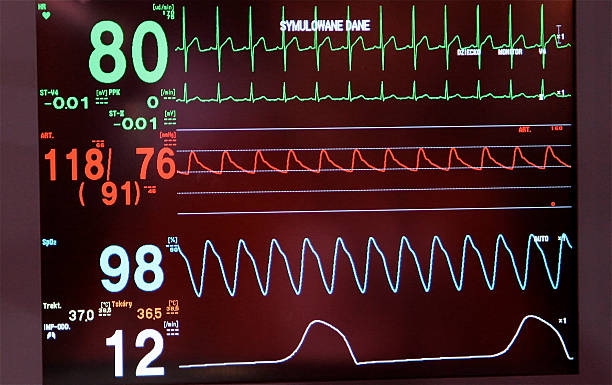 istock EKG ECG diagnosis waveform recording heart rhythm electrical activity 533672125
