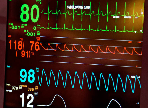istock EKG ECG diagnosis. Recording heart rhythm electrical activity. Simulation 533695053