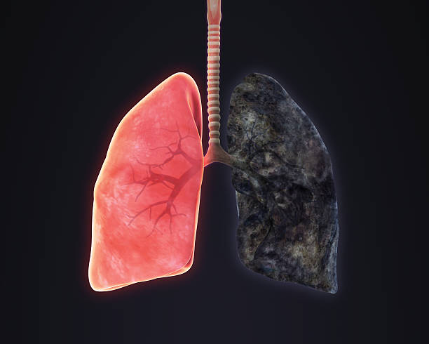 pulmão saudável e os fumadores ilustração do pulmão - human lung tuberculosis bacterium emphysema human trachea - fotografias e filmes do acervo