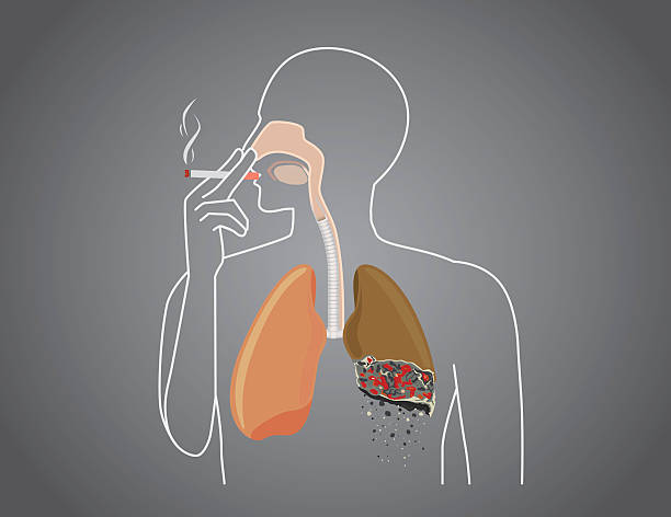 ilustrações, clipart, desenhos animados e ícones de humana incendiadas pulmão com fumantes - inhaling human lung problems anatomy