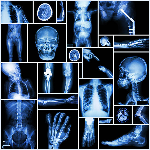 x 線の複数の人」、「整形手術」と「複数の疾患 cm - cat scan pelvis hip human spine ストックフォトと画像