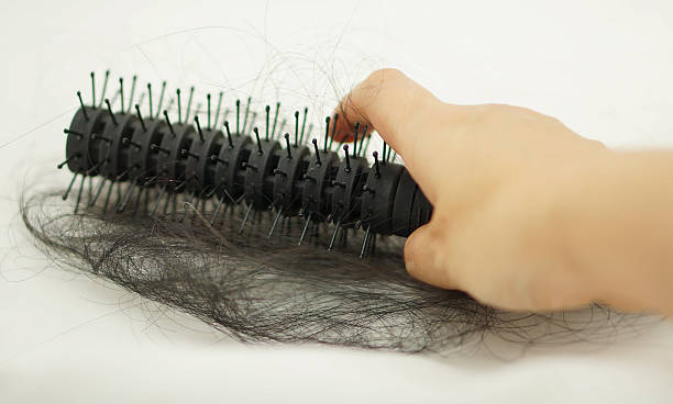 istock Women hand holding loss hair comb 534361753