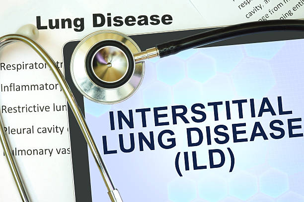 comprimido con word neumopatía intersticial (ild), y un estetoscopio. - interstitial fotografías e imágenes de stock