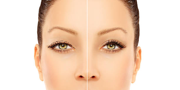 istock Perforation lines on females face, plastic surgery concept. 534501251