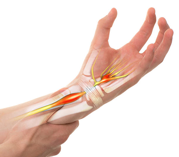 Carpal Tunnel Syndrome - Wrist Pain isolated Carpal Tunnel Syndrome - Wrist Pain isolated on white (transparent bones) decade stock pictures, royalty-free photos & images