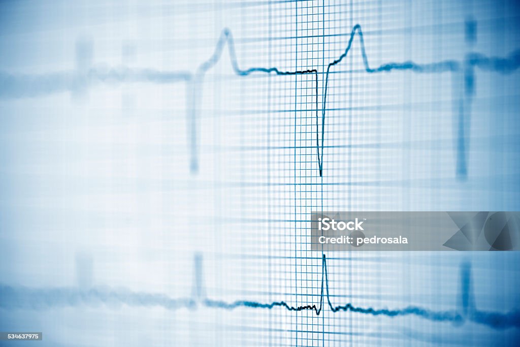 Electrocardiogram Close up of an electrocardiogram in paper form. Backgrounds Stock Photo