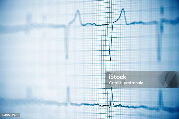 Electrocardiogram Stock Photo - Download Image Now - Backgrounds, Healthcare And Medicine, Medical Exam