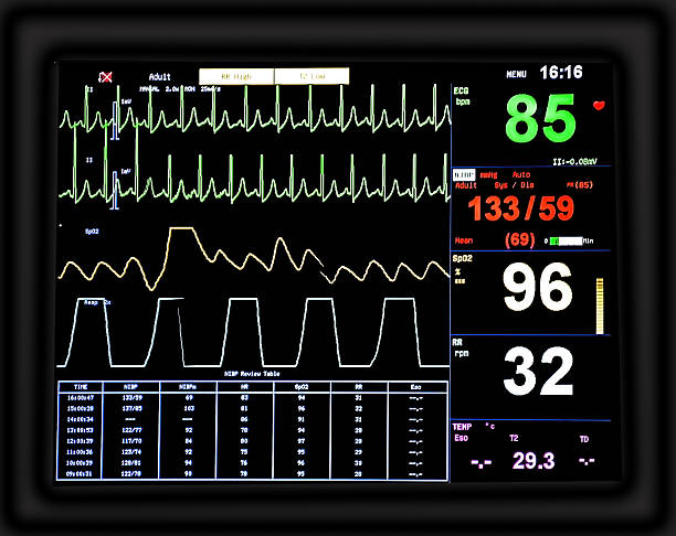 monitor ekg - human heart surveillance computer monitor pulse trace fotografías e imágenes de stock