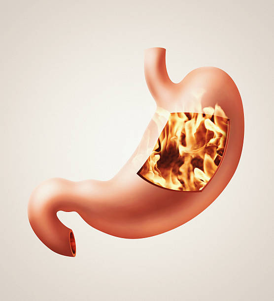 istock Stomach heartburn concept 534924397