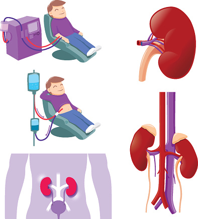 Hemodialysis and peritoneal dialysis are both used to treat kidney - vector illustration