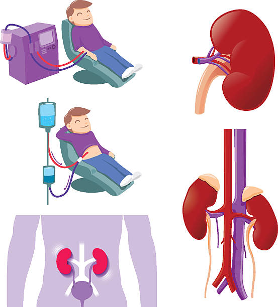 Kidney Medical Hemodialysis and peritoneal dialysis are both used to treat kidney - vector illustration peritoneal dialysis stock illustrations