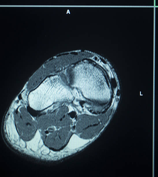 istock MRI scan test results foot toes injury 535280325
