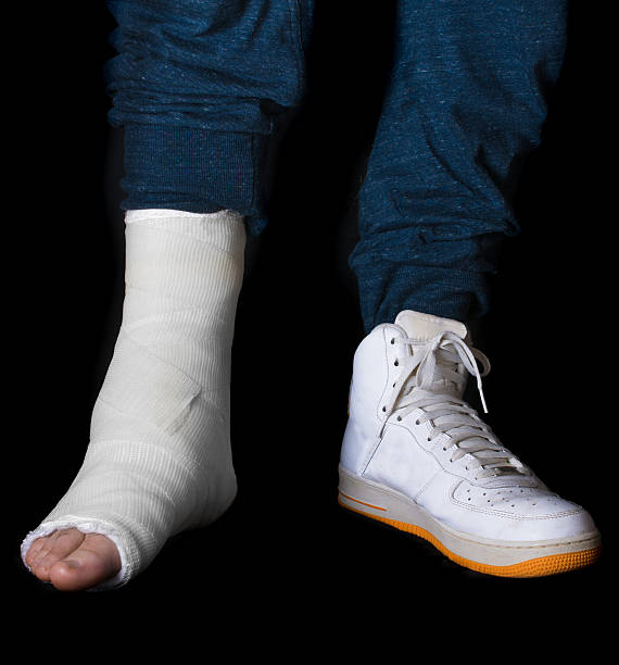 istock Young man with a broken ankle and a leg cast 535415092