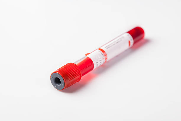 istock blood test tube with blood 535470452