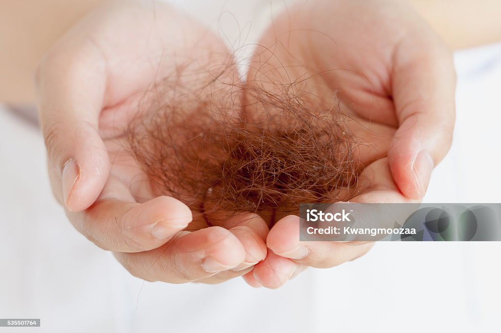 Hair loss Hair loss, hand holding lost hair Adult Stock Photo