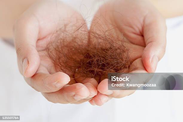 Hair Loss Stock Photo - Download Image Now - Adult, Alopecia, Black Color