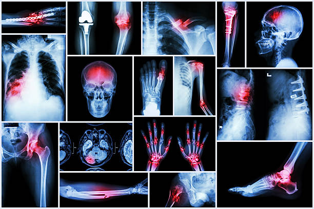 コレクションの x 線を複数の疾患 - cat scan pelvis hip human spine ストックフォトと画像
