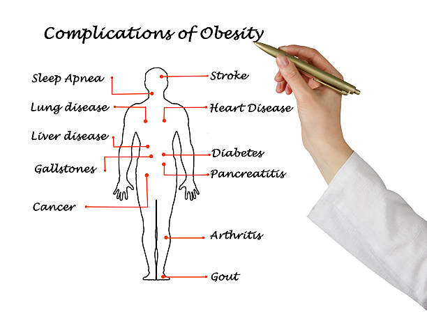 istock Complications of Obesity 535912311