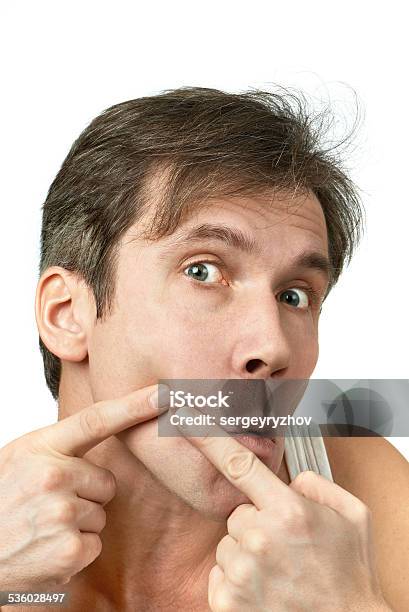 Men Squeezing A Pimple Stock Photo - Download Image Now - Acne, Adult, Adults Only