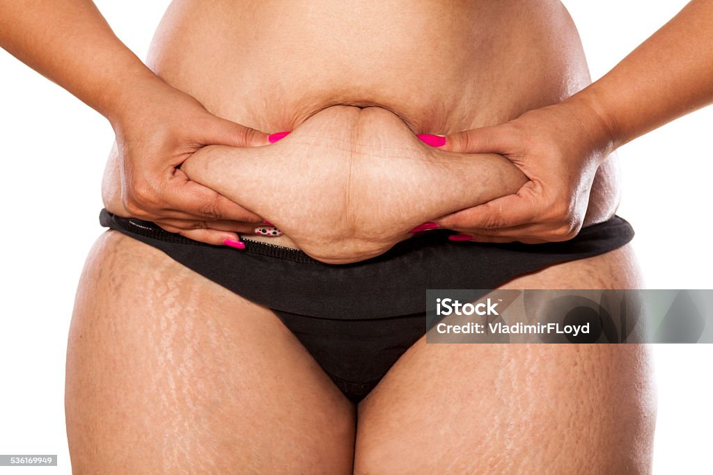 Very fat woman pinching her stomach with her ​​fingers very fat woman pinching her stomach with her ​​fingers 2015 Stock Photo