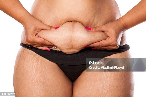 Very Fat Woman Pinching Her Stomach With Her Fingers Stock Photo - Download Image Now