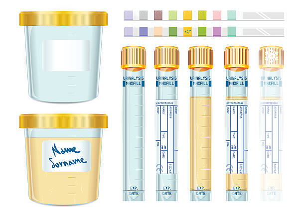 illustrazioni stock, clip art, cartoni animati e icone di tendenza di analisi delle urine con tappo giallo, del vuoto, pieno, congelati e dipis - collection tubes