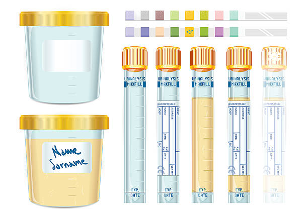 Urinalysis Yellow Cap Tubes Set, empty, filled, frozen and dipis vector art illustration