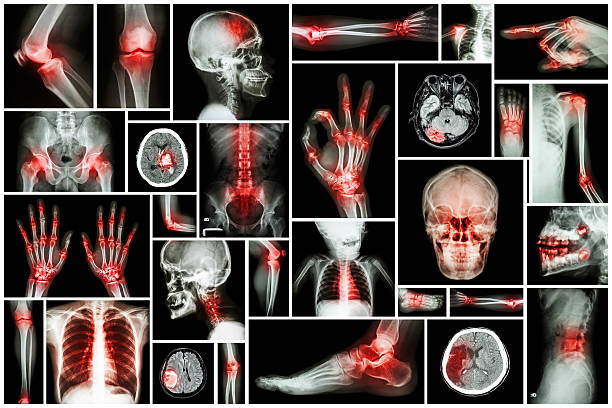 istock X-ray multiple part of human with multiple disease 536247809