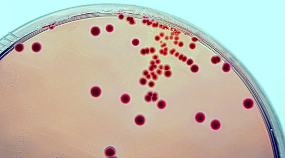 E. coli grown on an agar plate over night. The colonies are red, indicating lactose fermentation. Every colony represents one single bacterium. It takes 20 minutes for one E. coli bacterium to multiply itself.