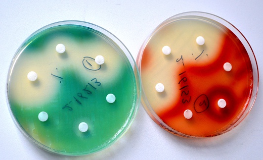 Pseudomonas aeroginosa (green) and Serratia marcescens (red) grown on agar plates over night. Antibiotic sensitivity is measured by the size of 