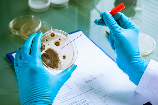 Germs growing on an agar plate in laboratory