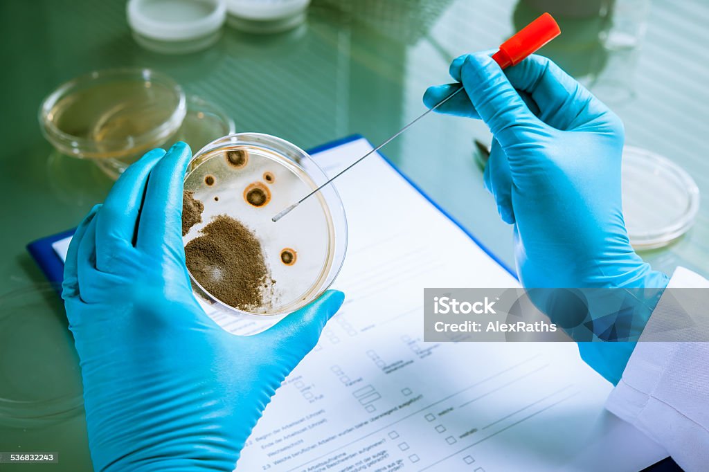 Agar plate with growing germs Germs growing on an agar plate in laboratory 2015 Stock Photo