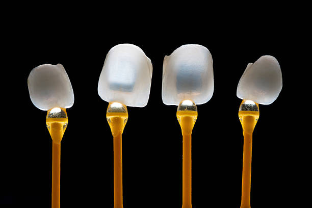 Dental Veneers stock photo