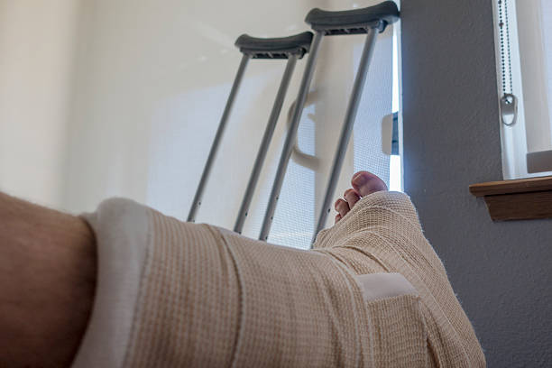 pessoa ferida com torcido ou quebrada tornozelo pé muletas - podiatrist podiatry orthopedic surgeon human foot - fotografias e filmes do acervo