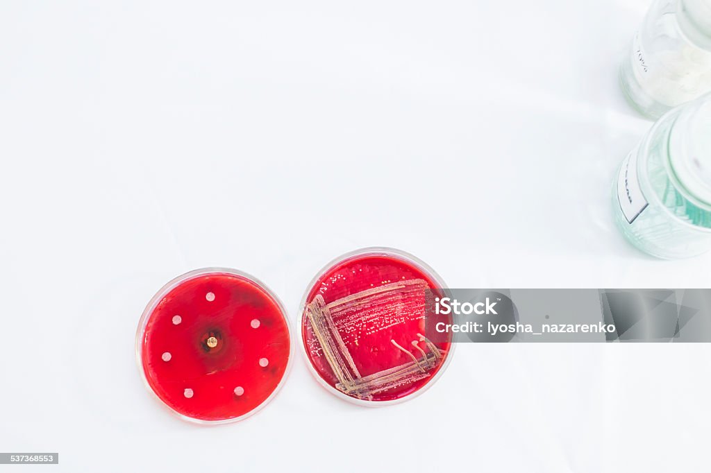 Two Petri dishes with different bacteria growing in them. Two Petri dishes with bacteria growing in them 2015 Stock Photo