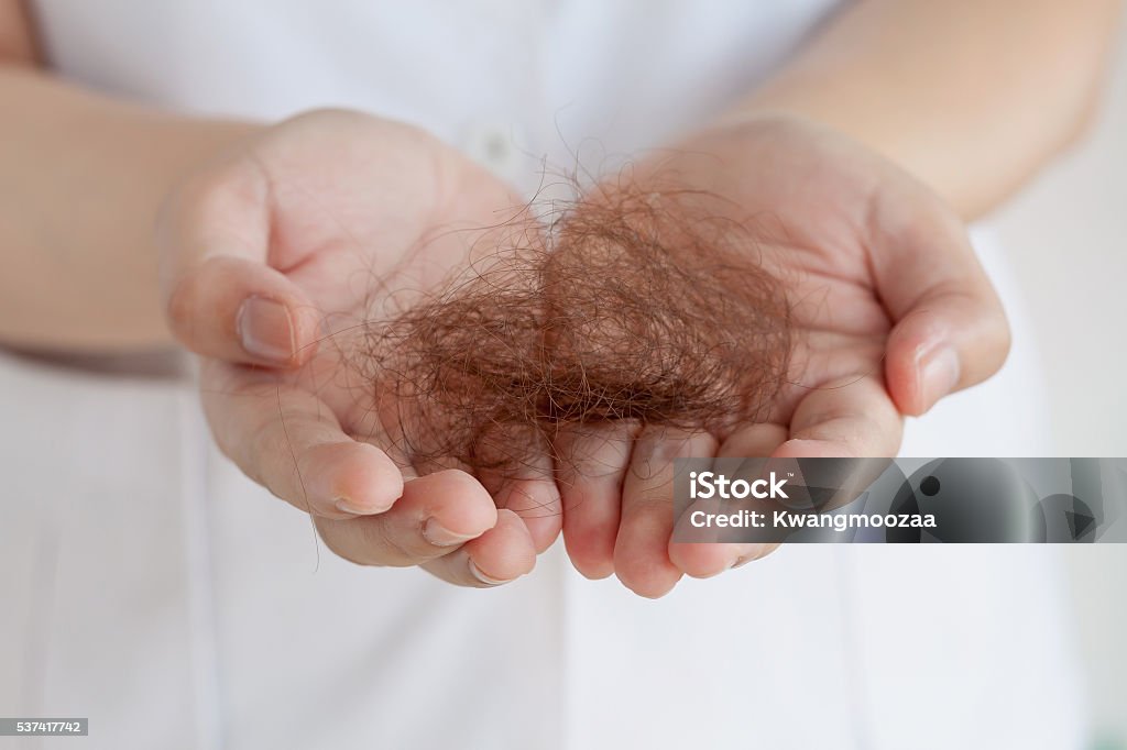 Hair loss Hair loss, hand holding lost hair Adult Stock Photo