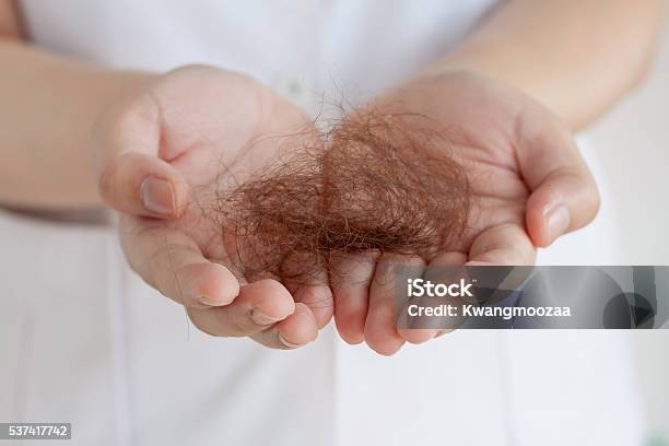 Hair Loss Stock Photo - Download Image Now - Adult, Alopecia, Backgrounds