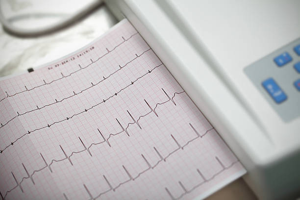 cardiography ます。方法で医学ます。 - 心臓刺激伝導系 ストックフォトと画像