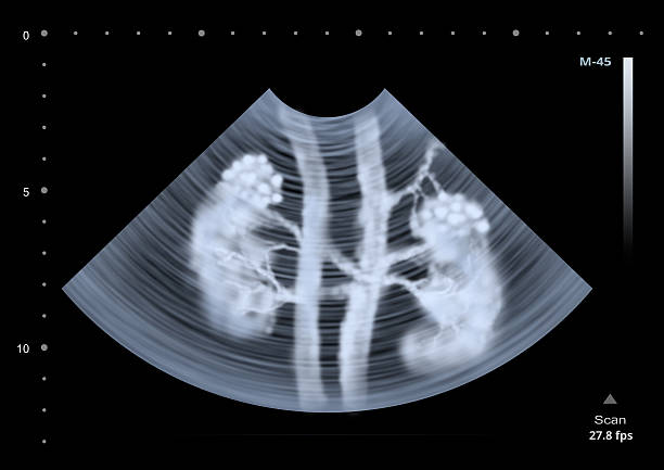 badanie usg skanowanie ludzkiego nerek pani dziecka. ilustracja - stomach the human body abdomen human digestive system zdjęcia i obrazy z banku zdjęć