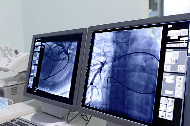 모니터 화면 영상의학. - radiologist x ray computer medical scan 뉴스 사진 이미지