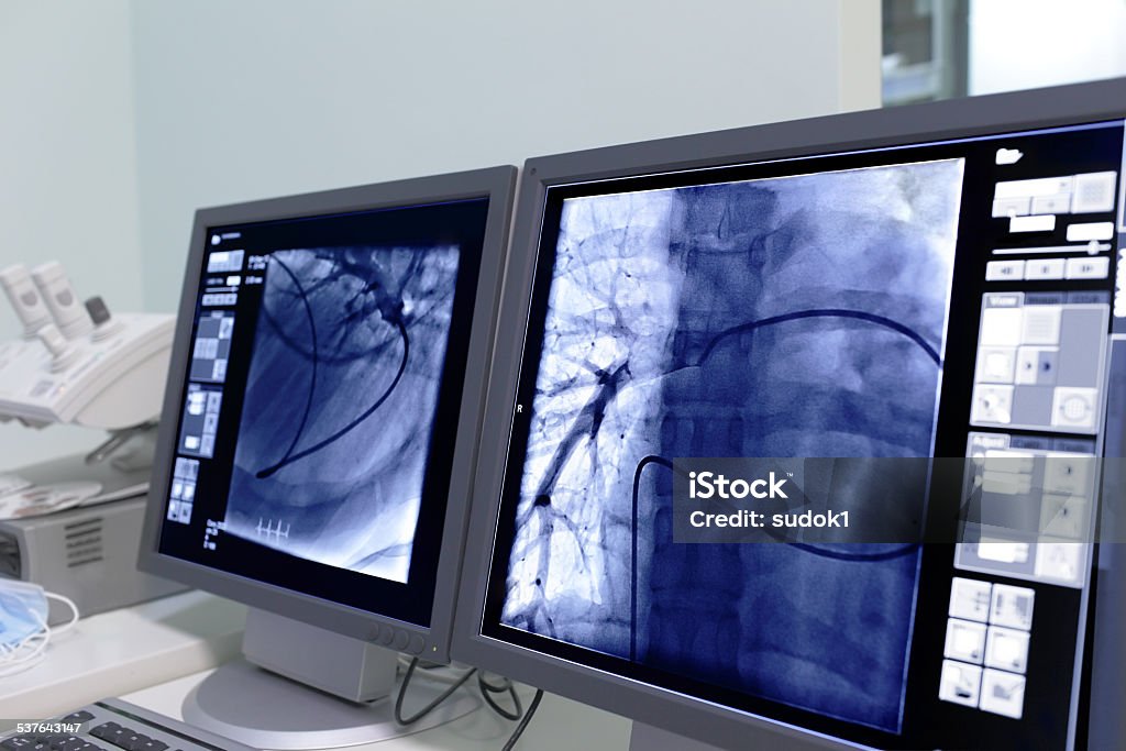 Monitor screen in radiology. Surgery Stock Photo