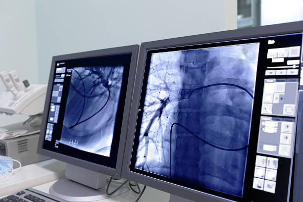 Monitor screen in radiology. Monitor screen in radiology. coronary artery photos stock pictures, royalty-free photos & images