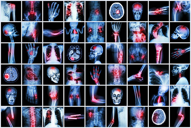 x-ray plusieurs maladie de enfant et adulte - x ray x ray image shoulder human arm photos et images de collection