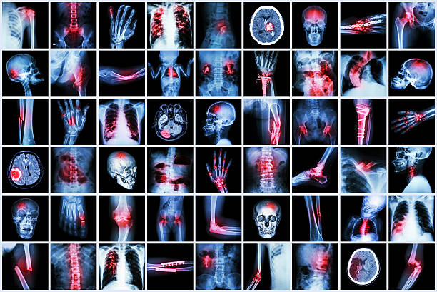x 線を複数の疾患のお子様と大人用 - cat scan pelvis hip human spine ストックフォトと画像