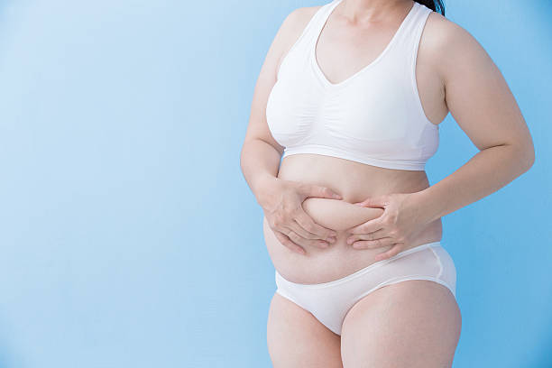 istock Fat overweight woman 537842318