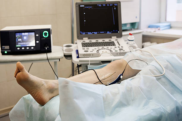 istock Cosmetic Surgery, varicose veins 537894171