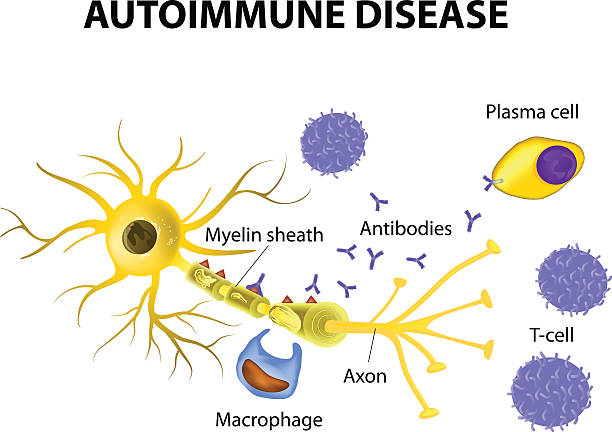 autoimmune ディジースます。このメカニズム neuronal の損傷が多発性硬化症 - macrophage human immune system cell biology点のイラスト素材／クリップアート素材／マンガ素材／アイコン素材