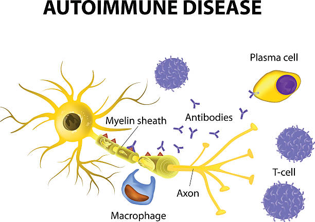 자가면역 질환. 이 매커니즘 신경세포 손상 다발성 경화증 - macrophage human immune system cell biology stock illustrations