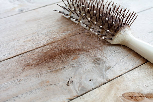 hair loss Hair loss, Close up of hairbrush with lost hair on wood table hairless animal photos stock pictures, royalty-free photos & images